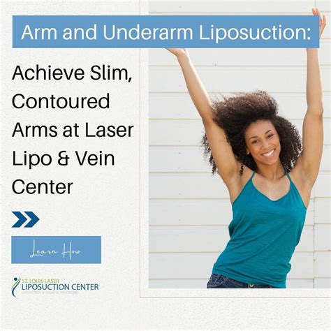 liposuction cost st louis|Liposuction in St. Louis, MO 